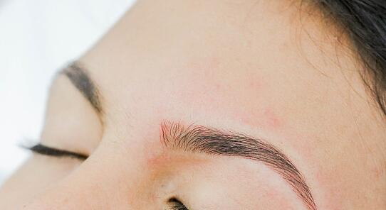 北京喬雅登名醫(yī)挖掘，新榜單首揭誰更強(qiáng)？技術(shù)絕優(yōu)對決揭曉！