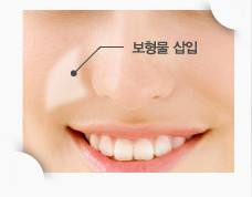 福州薛克乾醫(yī)生的醫(yī)療實(shí)力如何？詳細(xì)介紹該醫(yī)生的個人經(jīng)歷及患者口碑評價，還附有項(xiàng)目價格表。