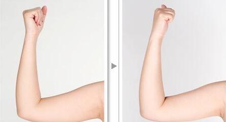 北醫(yī)三院謝詳主刀點評：五星植發(fā)案例驚艷登場