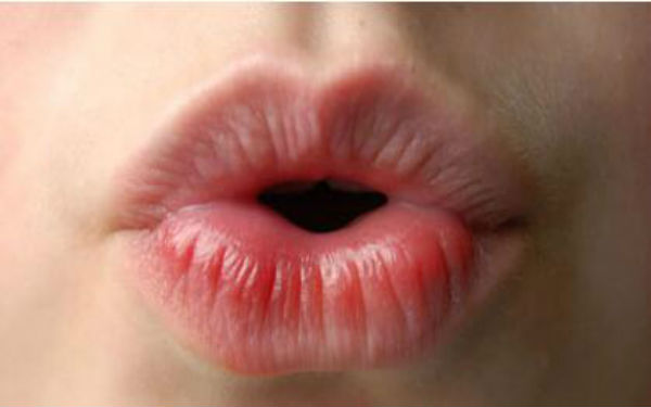 2023成都抬頭紋剝離大型醫(yī)生(董灜、周斌、劉國權(quán)當(dāng)屬當(dāng)?shù)孛麣飧?