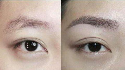 樸相炫醫(yī)生雙眼皮效果怎么樣？真實(shí)用戶(hù)口碑分享！