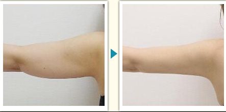 衢州市整容醫(yī)院哪家好？了解衢州市整容醫(yī)院的專業(yè)團(tuán)隊(duì)和先進(jìn)設(shè)備