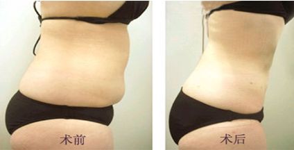 上海整形臉部哪家醫(yī)院好？詳細介紹上海優(yōu)質(zhì)整形醫(yī)院及專家經(jīng)驗！