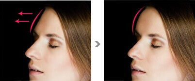 2023天津去眼部皺紋醫(yī)生推薦前10名(申銳湜、陳山偉、朱曉峰專家實(shí)力細(xì)數(shù)、價(jià)格公布)