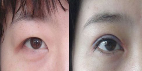 蘭州中藥祛斑哪家醫(yī)院好？解析蘭州本地祛斑療法和專業(yè)醫(yī)院推薦