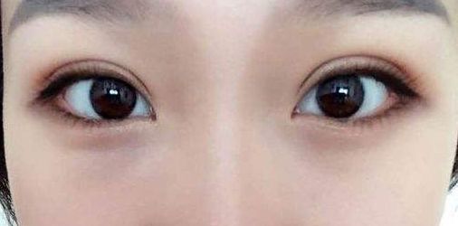 永州地區(qū)哪家正規(guī)整形醫(yī)院好？