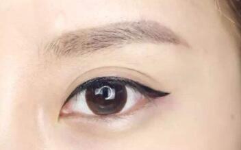 朱春艷醫(yī)師解析雙眼皮技術(shù)與手術(shù)方式，附詳細(xì)醫(yī)生介紹和診療科室信息