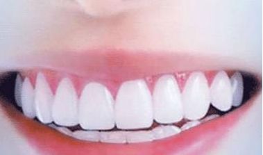 呢？衢州美萊整形美容醫(yī)院簡介、技術優(yōu)勢、口碑在線查看！