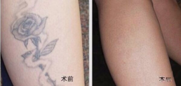 不二選擇！上海鼻修復專家徐永豐、劉仁輝搶占熱門名單成功！個人實力攀升不可阻擋！