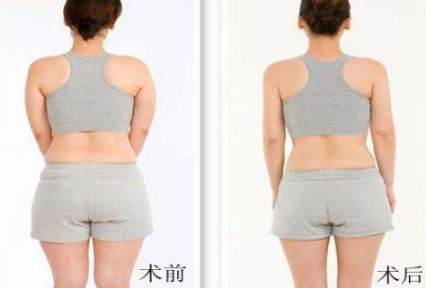 杭州哪家祛痘醫(yī)院好？綜合評(píng)測(cè)幫你選擇！