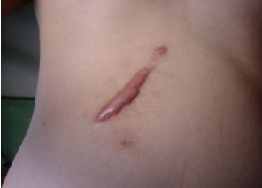 南寧激光美容中心哪家好？探索最佳的南寧激光美容中心排名及用戶口碑