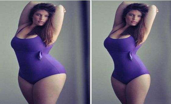 沈陽哪家醫(yī)院割雙眼皮效果好，推薦2023年最受歡迎的醫(yī)院