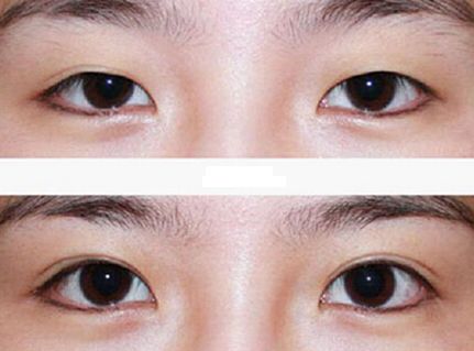 廣州整容鼻子技術(shù)排名前列的醫(yī)院有哪些？