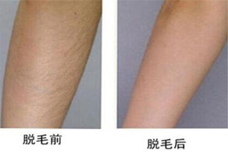 2023廣州激光治療酒渣鼻專家在榜名單前10位(梁曉姻、鄭載浩、盧剛高居榜首)