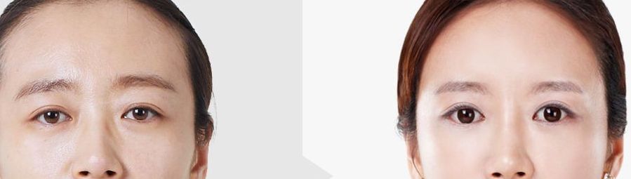 昆明祛疤醫(yī)院哪家好，正規(guī)機(jī)構(gòu)推薦