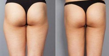 深圳面部填充醫(yī)院排名與選擇，哪家好？