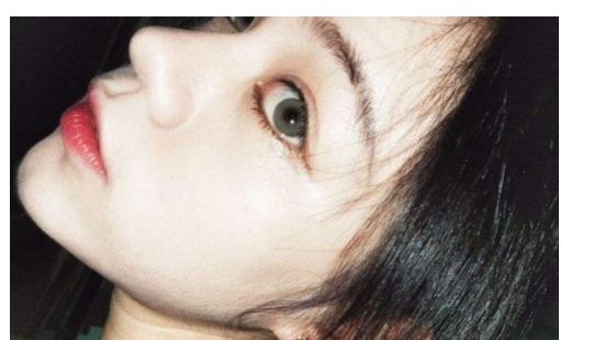 找一家靠譜的汕頭去除疤痕醫(yī)院？看這里！