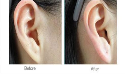 如何選擇西安哪家醫(yī)院術(shù)后康復(fù)好的機(jī)構(gòu)？