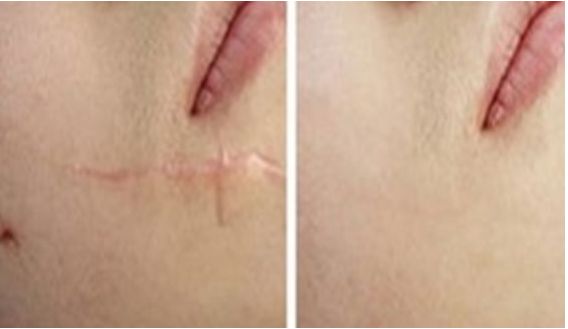 成都整容醫(yī)院哪家更專業(yè)靠譜？哪家整容醫(yī)院口碑好？