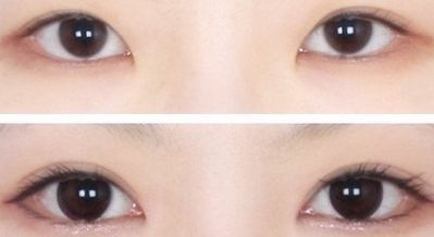 西安王者風(fēng)范嫩膚哪家好？一文讀懂西安嫩膚機(jī)構(gòu)排行榜