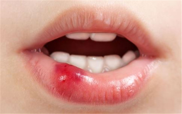 2023佛山澳洲mmV膠原蛋白肽美白專家前十位口碑榜(李雙雙、王麗君、蘇暉展做手術(shù)名氣很大哦)