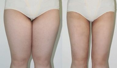 西安北郊美容整形哪家好？揭秘西安北郊最受歡迎的美容整形機(jī)構(gòu)排名