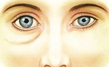 酒糟鼻南寧哪家醫(yī)院好？專(zhuān)家推薦南寧哪家醫(yī)院治療酒糟鼻效果最好