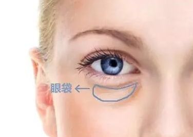 蘇州哪家醫(yī)院治療黃褐斑效果好？