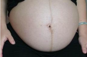 上海哪里有鼻修復(fù)專家？選擇困難癥仙女來了，點擊查看醫(yī)生介紹和價格！