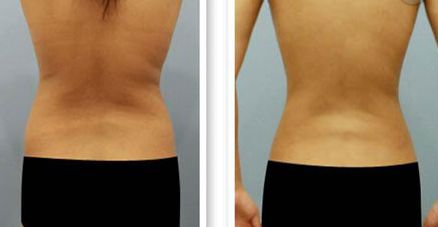 【2023最新】蘭州哪家醫(yī)院治療祛紅血絲效果好？