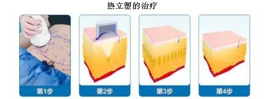 上海臉部祛斑哪家醫(yī)院好？揭秘上海市最受歡迎臉部祛斑醫(yī)院排行榜