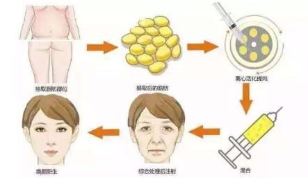 長(zhǎng)沙鼻修復(fù)醫(yī)生推薦！多位專家實(shí)力PK，功力高出你的期待！最適合急需求的技術(shù)實(shí)力誰(shuí)更強(qiáng)？