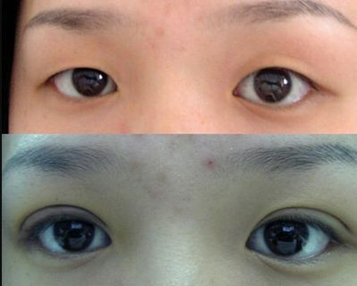 唐山哪家鼻子整形醫(yī)院好？權(quán)威專家為您解答