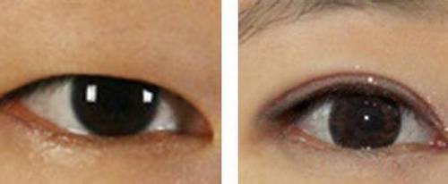 2023廣州去除面部雀斑權(quán)威醫(yī)生排行榜前10位(聶云飛、?楊德發(fā)、陳玉芳是正規(guī)機(jī)構(gòu))