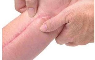 廣州哪家美容醫(yī)院好？詳細比較廣州頂級醫(yī)療機構(gòu)個美容醫(yī)院的優(yōu)缺點