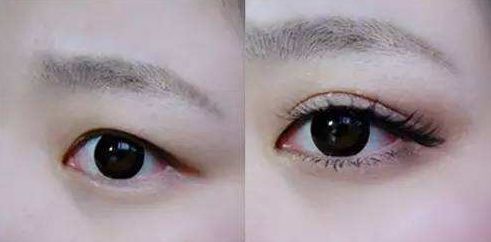 天津祛痘醫(yī)院哪家好？解決痘痘問(wèn)題，選擇最佳去痘醫(yī)院