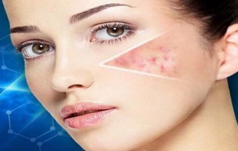 昆明祛痘效果最好的美容醫(yī)院推薦！