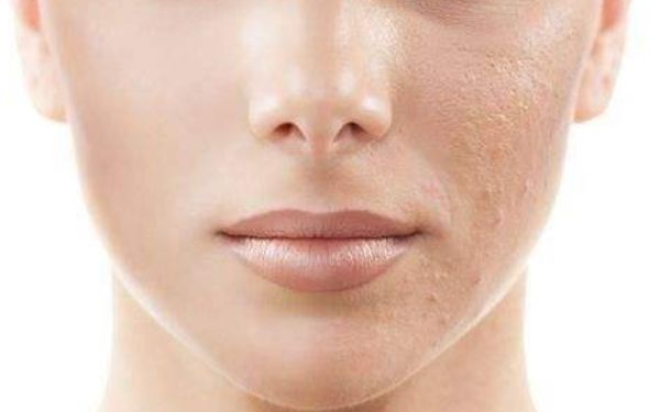 成都華顏隆鼻價格高嗎？坐診醫(yī)生介紹及收費(fèi)情況詳解