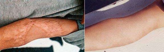 北京下顎骨手術(shù)哪家好？全面解析北京市優(yōu)質(zhì)下顎骨手術(shù)醫(yī)院及醫(yī)生推薦