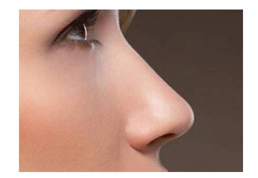 昆明狐臭求治，哪家醫(yī)院治療效果好？