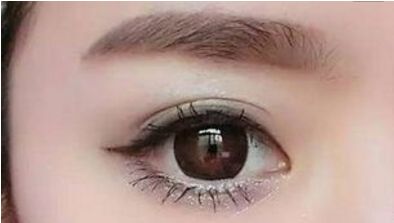 沈正洲如何進行雙眼皮手術？醫(yī)生介紹、手術費用、成功案例、患者口碑分享