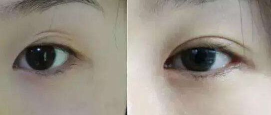 南京哪家假體豐胸醫(yī)院好？醫(yī)術(shù)精湛、效果明顯的南京豐胸?？漆t(yī)院推薦