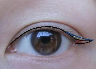 2023昆明隆胸整形哪家醫(yī)院好？專家推薦與真實案例一覽