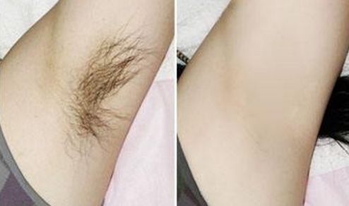 成都M唇做的好的醫(yī)院有哪些？