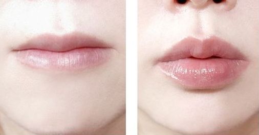 南京哪家醫(yī)院治療黃褐斑效果好？