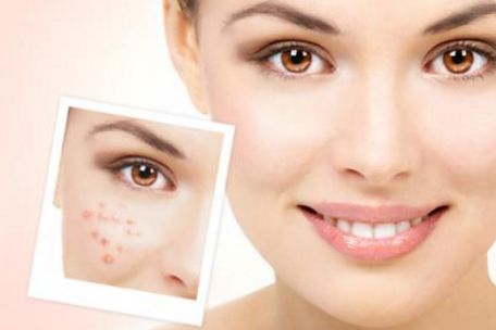 蘇州治療痘痘最好的醫(yī)院有哪些？