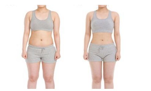 上海哪家醫(yī)院能有效去除妊娠紋，讓肌膚重新恢復(fù)緊致？