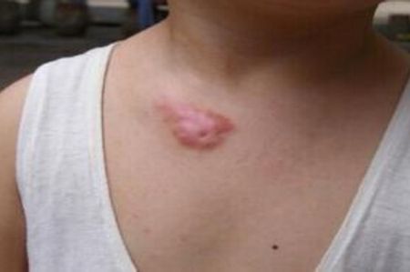 上海切眼袋手術(shù)醫(yī)院排名及口碑如何？