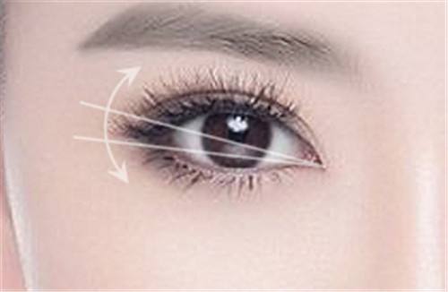 郭勇醫(yī)生的坐診地點及發(fā)際線種植案例，完美解決“禿頭少女”之困