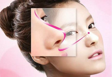 深圳駝峰鼻矯正哪家好？專業(yè)醫(yī)生推薦與真實案例分享！